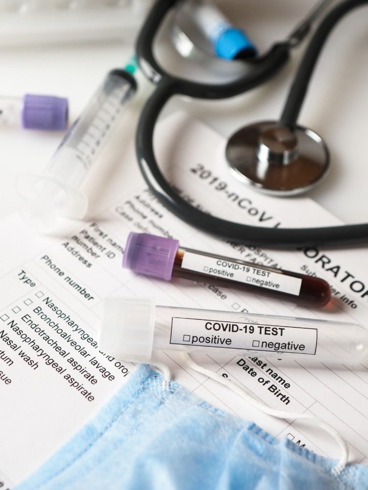 vzorky krvi a krvný test na protilátky proti koronavírusu a sars cov 2 zistiteľné v laboratóriu slinami