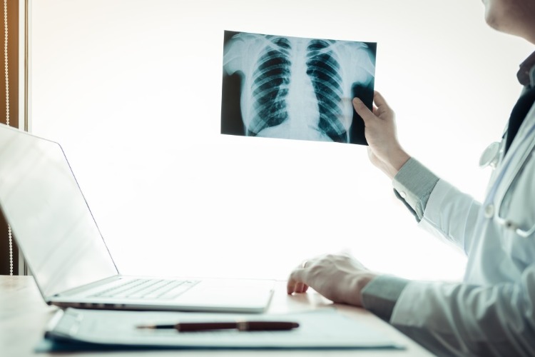 lekár vyšetrujúci röntgenové vyšetrenie pacienta s koronavírusom a zápalom pľúc