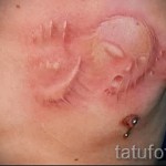 fehér tetoválás - fotó a 29032016 kész minta megtestesítőjével 1