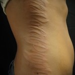 tetoválás fehér tintával - fotó a kész rajz egyik változatával a 29032016 -ból 1