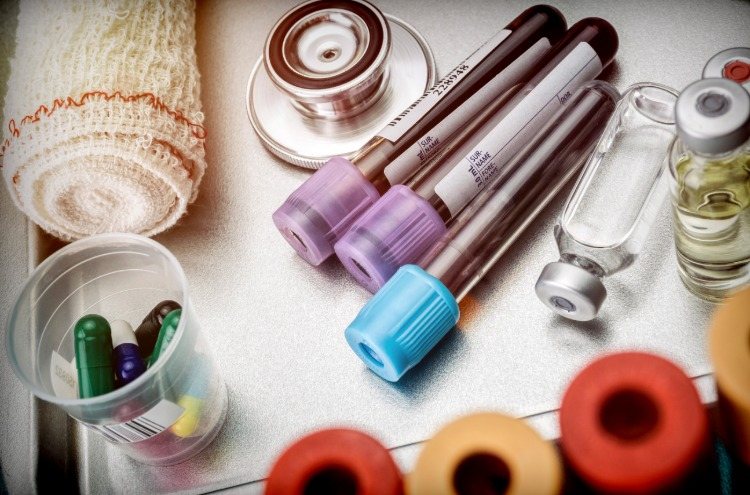 tri vzorky krvi ležiace vedľa seba