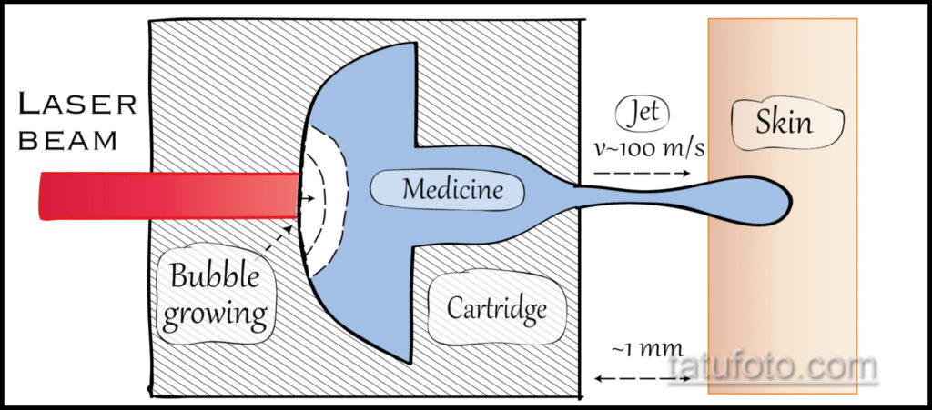 Budućnost tetoviranja bez igle nova je tehnologija ubrizgavanja bez igle i njezina primjena u tetoviranju - fotografija 5