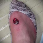 fotó a katicabogár tetoválásról # 203 - a minta érdekes változata, amely könnyen használható változtatásra és alkalmazásra katicabogár tetoválásként a realizmusban