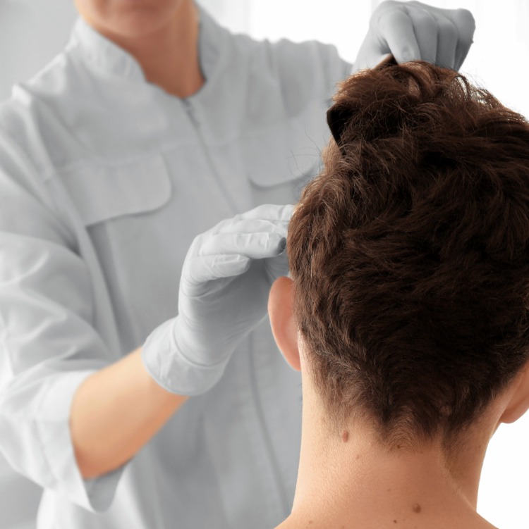 poraďte sa s lekárom v prípade vypadávania vlasov v dôsledku hormonálnej nerovnováhy nedostatok železa nedostatok vitamínu B12 hypertyreóza hypotyreóza