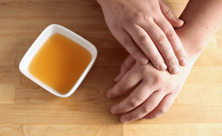 Med vlhkosť suchá pokožka rúk nechty