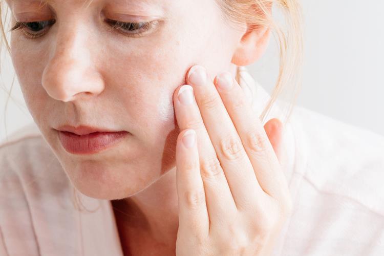 Červené škvrny na tvári od akné - Zapálené pupienky sú spôsobené nadprodukciou kožného tuku