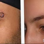 zdjęcie piercingu do brwi z dnia 06.06.2018 №146 - piercing do brwi -