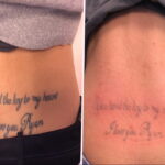 كيفية إزالة الوشم في الصالون والمنزل - 10022021 صورة - 15