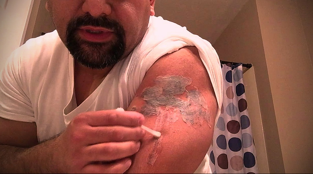 كيفية إزالة الوشم في الصالون والمنزل - 10022021 صورة - 4