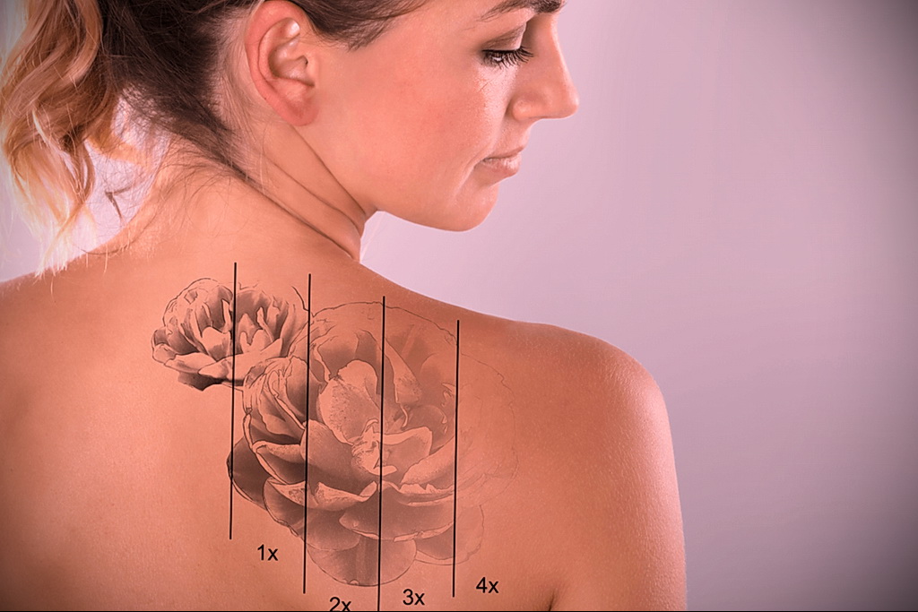 كيفية إزالة الوشم في الصالون والمنزل - 10022021 صورة - 5