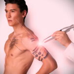 كيفية إزالة الوشم في الصالون والمنزل - 10022021 صورة - 9