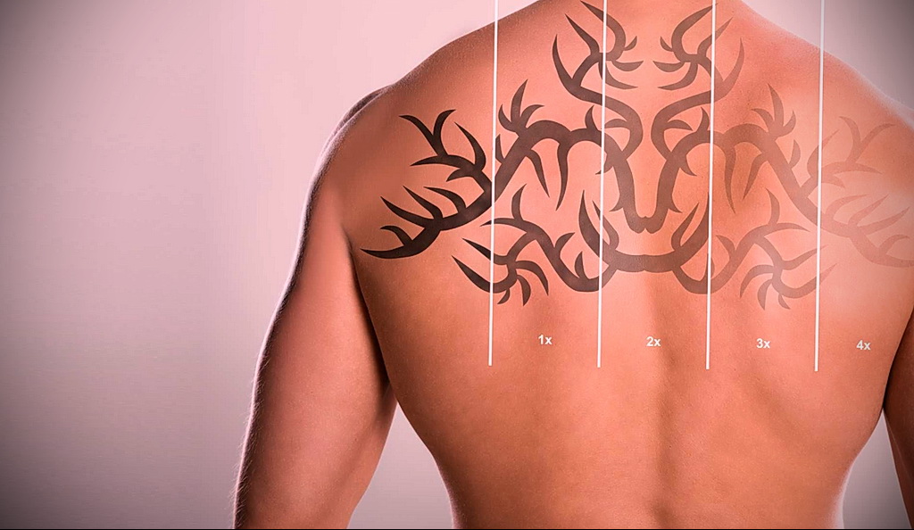 كيفية إزالة الوشم في الصالون والمنزل - 10022021 صورة - 7