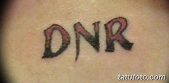 снимка Медицински татуировки от 22.04.2018 г. No 027 - Медицинска татуировка -