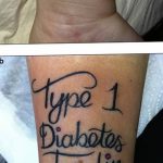 Медицински татуировки - колекция от снимки на интересни рисунки за татуировки 23523234