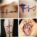 снимка Медицински татуировки от 22.04.2018 №002 - Медицински татуировки -