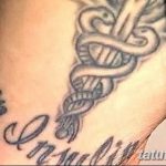 снимка Медицински татуировки от 22.04.2018 №008 - Медицински татуировки -