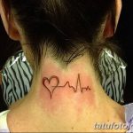 снимка Медицински татуировки от 22.04.2018 г. No 017 - Медицинска татуировка -