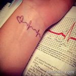 снимка Медицински татуировки от 22.04.2018 №026 - Медицински татуировки -