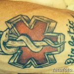 снимка Медицински татуировки от 22.04.2018 г. №030 - Медицинска татуировка -