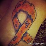 снимка Медицински татуировки от 22.04.2018 г. No 037 - Медицинска татуировка -