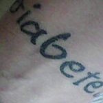 снимка Медицински татуировки от 22.04.2018 г. No 039 - Медицинска татуировка - 343453467345