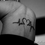 снимка Медицински татуировки от 22.04.2018 г. No 042 - Медицинска татуировка -