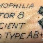 снимка Медицински татуировки от 22.04.2018 г. No 051 - Медицинска татуировка -