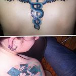 снимка Медицински татуировки от 22.04.2018 г. No 057 - Медицинска татуировка -