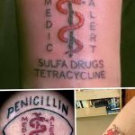 снимка Медицински татуировки от 22.04.2018 г. No 058 - Медицинска татуировка -