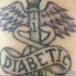 снимка Медицински татуировки от 22.04.2018 г. No 060 - Медицинска татуировка -