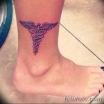 снимка Медицински татуировки от 22.04.2018 г. No 074 - Медицинска татуировка -