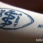 снимка Медицински татуировки от 22.04.2018 №081 - Медицински татуировки -