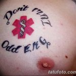 снимка Медицински татуировки от 22.04.2018 №083 - Медицински татуировки -