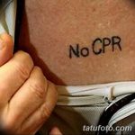 снимка Медицински татуировки от 22.04.2018 №086 - Медицинска татуировка -