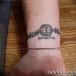 снимка Медицински татуировки от 22.04.2018 №097 - Медицински татуировки -