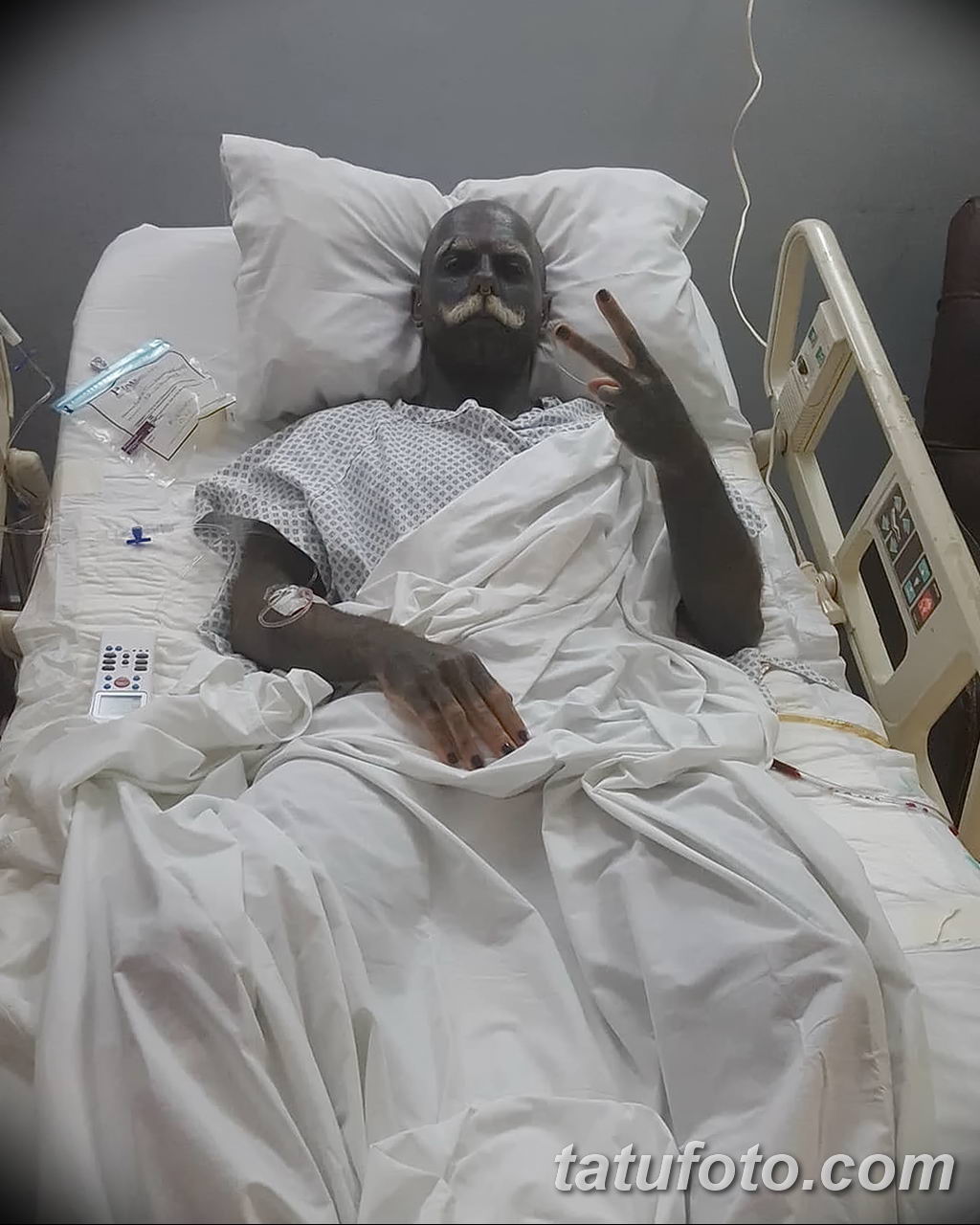 Nemam dovoljno tetovaža na 90 posto tijela - moram ukloniti penis i testise - fotografija 3