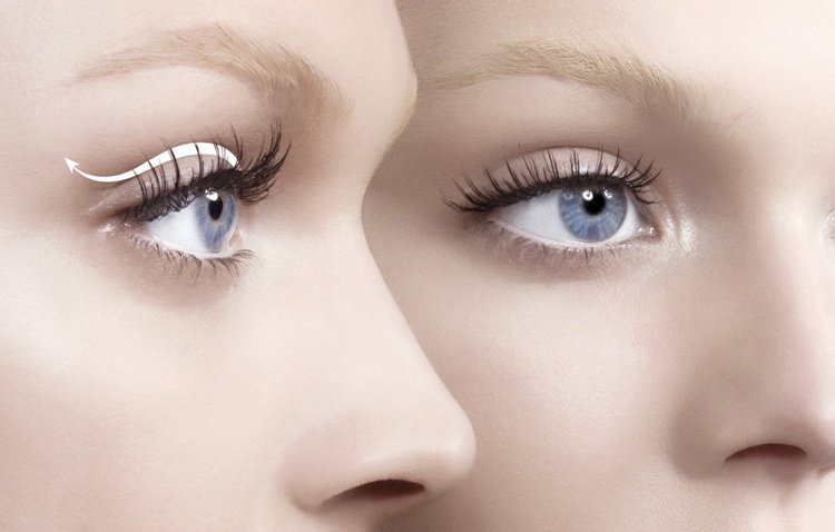 Odkedy sa starať o jazvy po zdvihnutí horného viečka