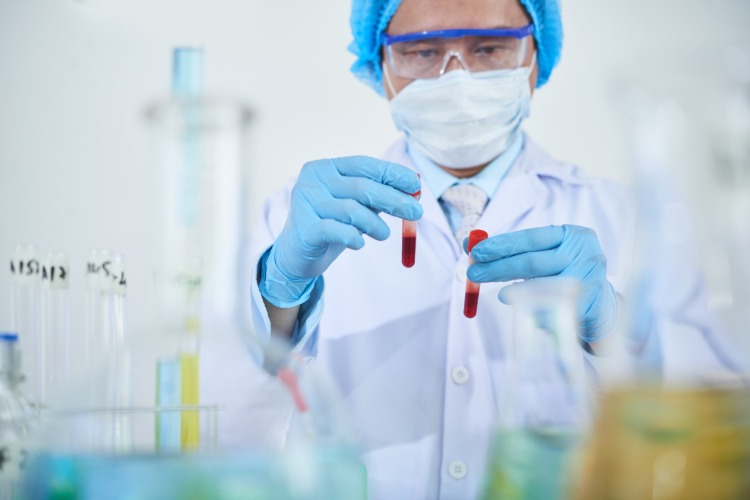 Výskumník v laboratóriu vyšetruje vzorky krvi od pacienta s HIV