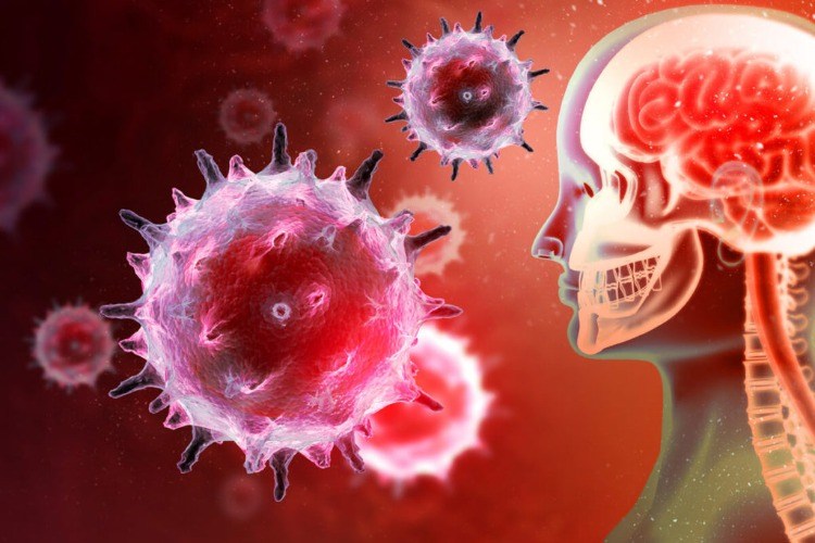 lymská choroba neurologické symptómy periférny nervový systém