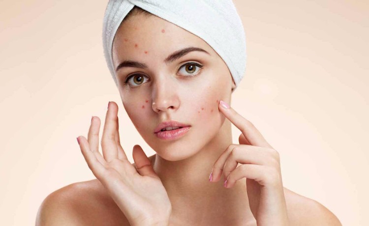 nekomedogénny význam starostlivosti o kozmetiku