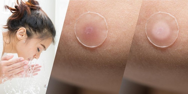 Správne používanie pokynov pre pupienky