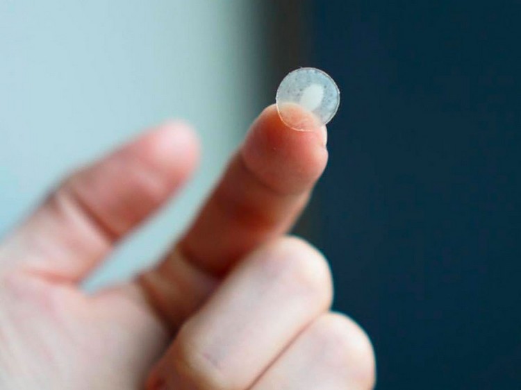 bezchybná pokožka s pupienkami sadra s hydrokoloidom