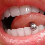 zdjęcie Piercing języka od 03.02.2018 №126 - Piercing języka -