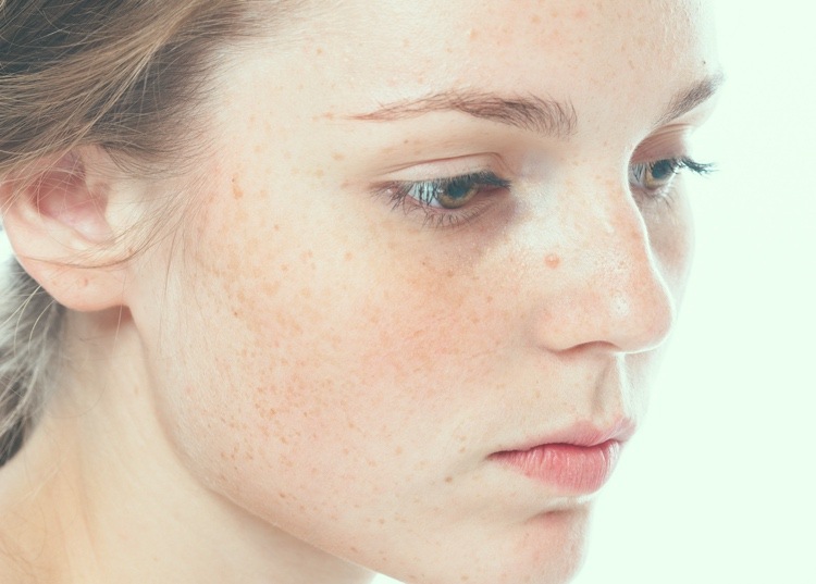 krásna žena myslí na operáciu nosa kvôli hrbovému nosu