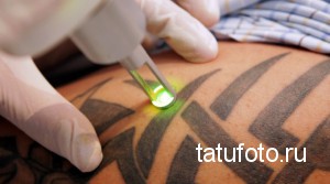 Contraindications and dangers hidden by a tattoo 1