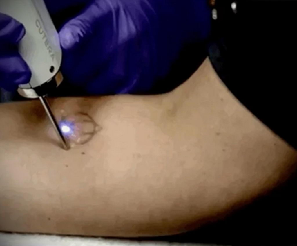 Moderne tetovaže koje se mogu isključiti - fotografija 2