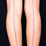 tetoválás íjak a lábakon hátsó fotó - fotó példa a kész tetoválásra 02052016 18