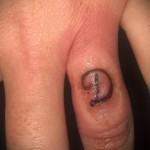 tetoválás d betű - fotó a kész tetoválásról - 20122015 № 6