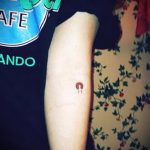 Tetováló mágnes - fényképes példa egy kész tetoválásra 24072016 -ból 7