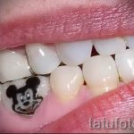 tetoválás Mickey egérrel az emberi fogakon - fotó